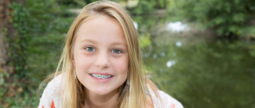 How Much Do Braces Cost – Getting The Priceless Smile