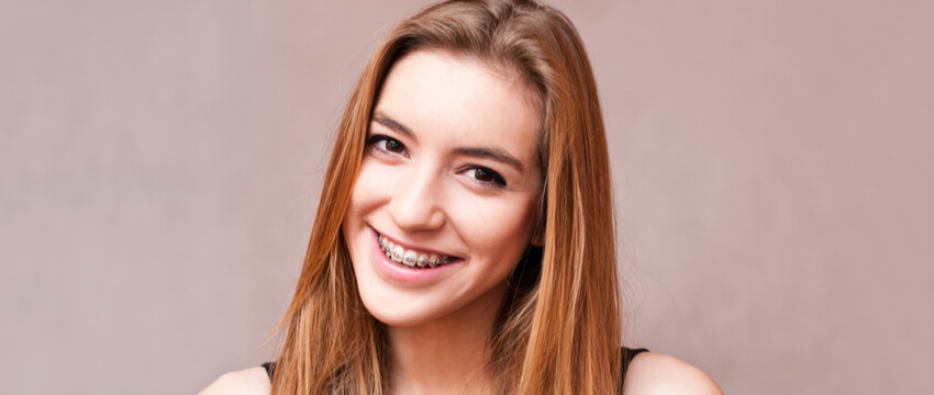 Braces Before And After – Expectations From Treatment