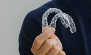 Clear Aligners Dual Arch