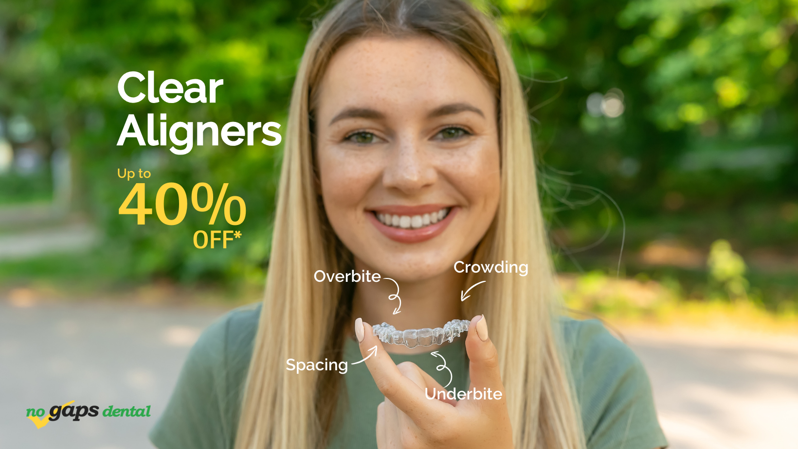 Clear Aligners Dual Arch Plans 40% OFF