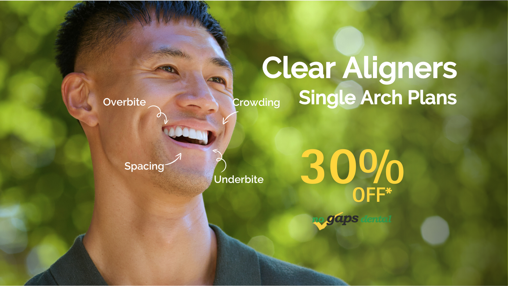 Clear Aligners Single Arch Plans 30% OFF