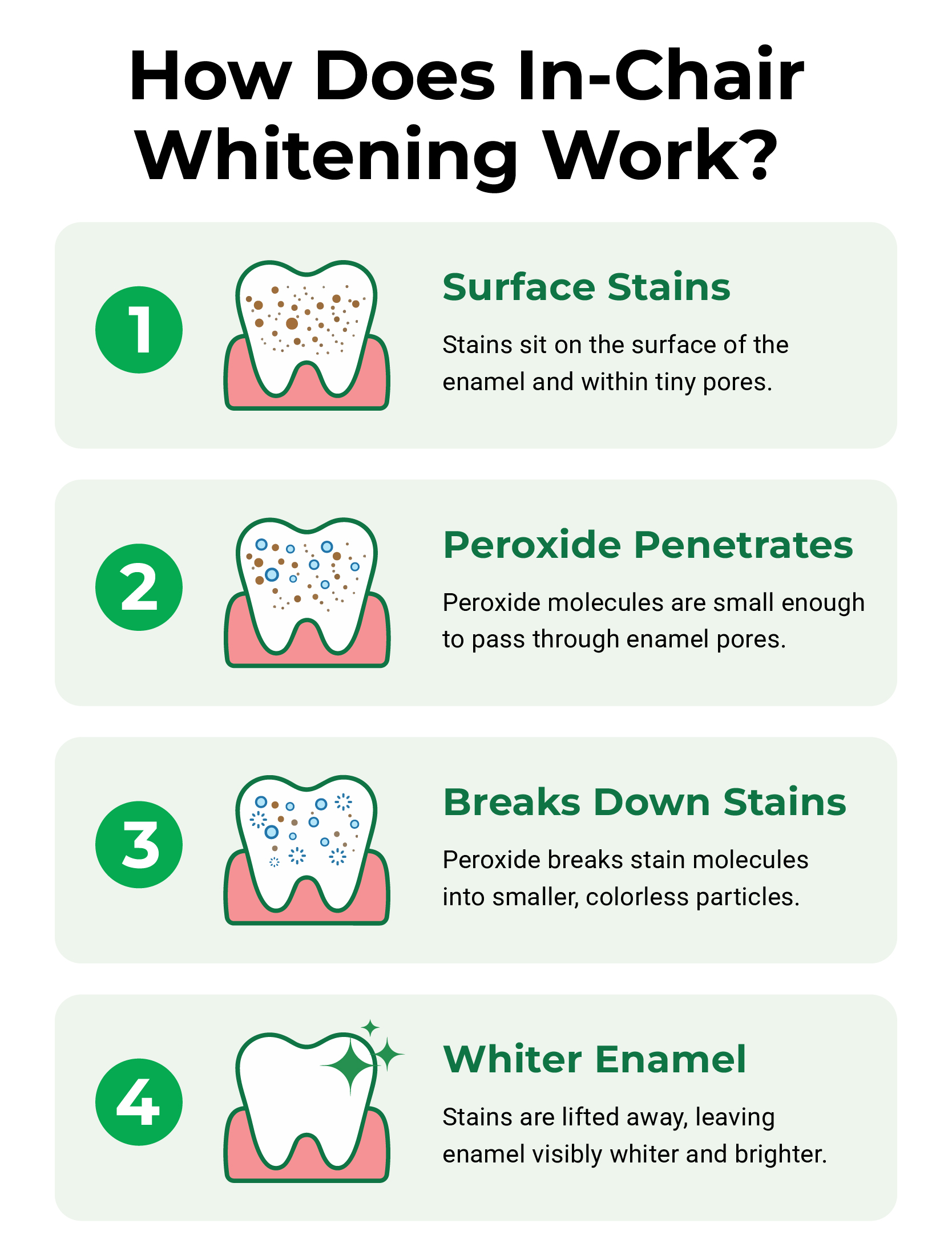 Infographic explaining how in-chair teeth whitening works across four steps: surface stains, peroxide penetration, stain breakdown, and whiter enamel.